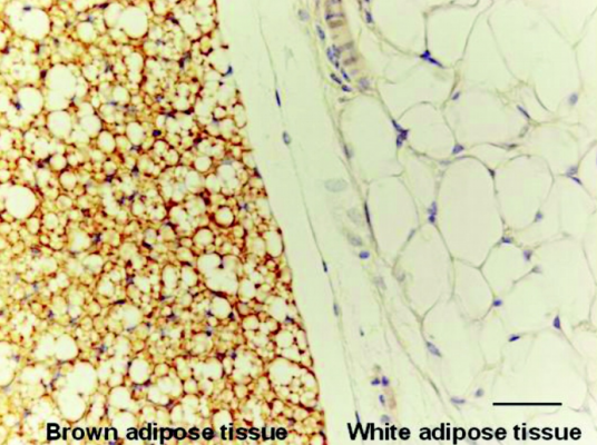 갈색지방, 하얀지방
