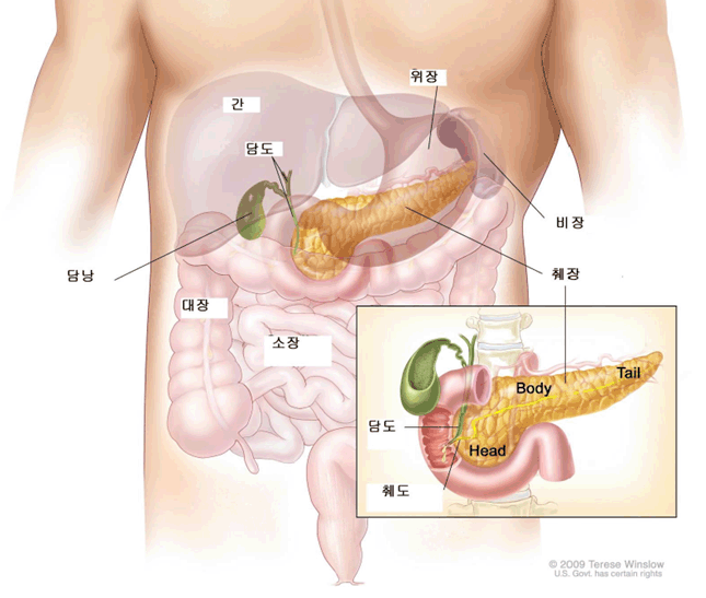 췌장 지방간 설탕