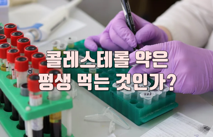 콜레스테롤 약은 평생