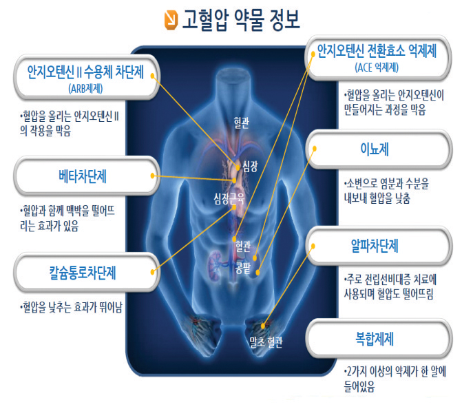 고혈압 약 종류
