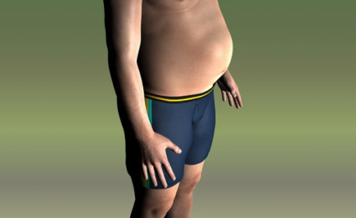 스트레스 체형 변화