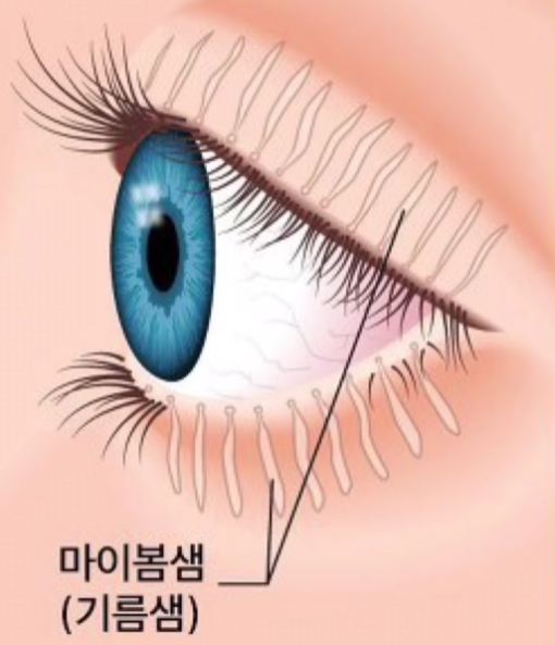 안구건조증에 좋은 오메가3