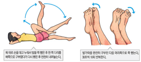 하지정맥류에 좋은 운동